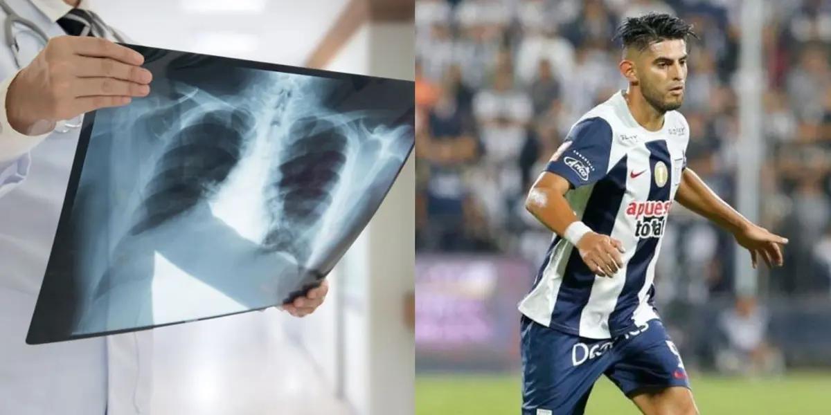 Carlos Zambrano se lesionó en el partido que Alianza Lima le ganó a UTC por el Torneo Clausura.