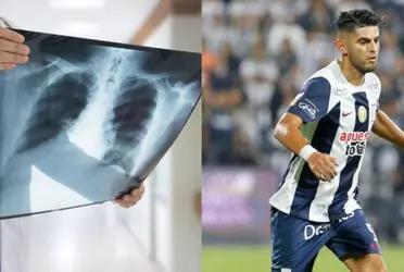 Carlos Zambrano se lesionó en el partido que Alianza Lima le ganó a UTC por el Torneo Clausura.